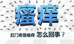 肛門瘙癢治不好嗎？先檢查病因就好辦！